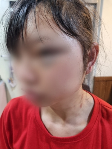 스포츠토토사이트 추천